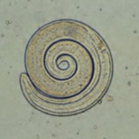 trichinae parasite as seen under a microscope